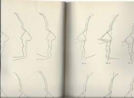 Victor Berglund - Studier öfver ansiktsprofilen förhållande till kranieprofilen 1914