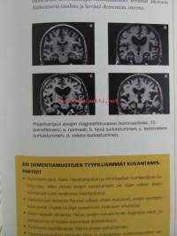 Kun muisti pettää - Muistihäiriöt ja dementia