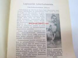 Lapsuusiän tuberkuloosista