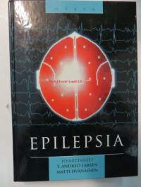 Epilepsia