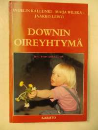 Downin oireyhtymä. Opas vanhemmille