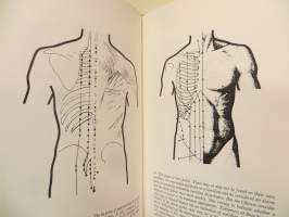 Acupuncture- Akupunktio