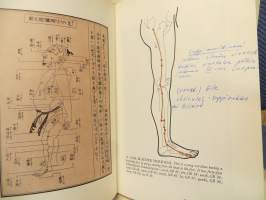 Acupuncture- Akupunktio