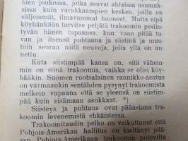 Trakoomista eli silmäpaskosta