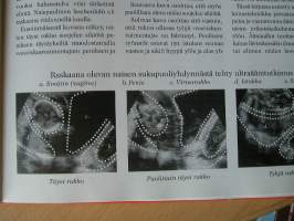 postikortti . kokoomus 1918-1978 kulkematon