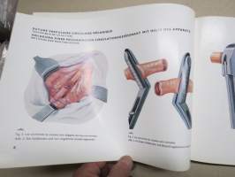 Atlas chirurgischer operationen mit anwendung von nähapparaten / -neuvostoliittolaisten kirurgisten välineiden kuvitettu luettelo - käyttöopas havaintokuvineen