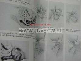 Manual of operative procedure and surgical knots