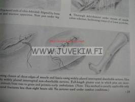 Manual of operative procedure and surgical knots