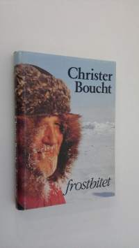 Frostbitet