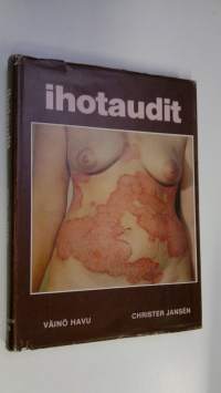 Ihotaudit