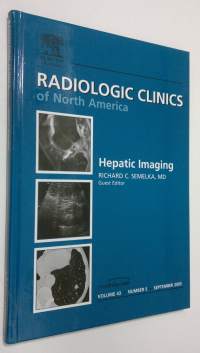 Hepatic Imaging : Radiological Clinics of North America - september 2005, vol 43 nr. 5