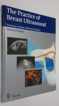 The Practice of Breast Ultrasound