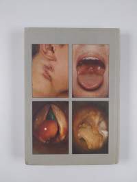 A Colour Atlas of E.N.T. Diagnosis