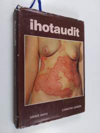 Ihotaudit