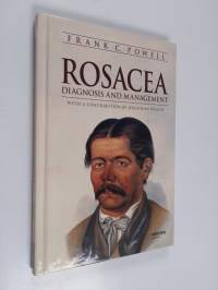 Rosacea : diagnosis and management