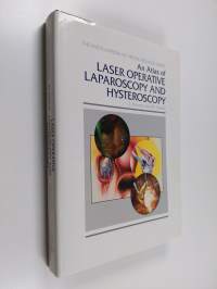 An Atlas of Laser Operative Laparoscopy and Hysteroscopy
