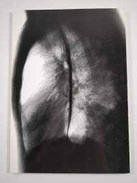 Rapid Etiological Diagnosis of Pneumonia in Young Men (signeerattu, tekijän omiste)