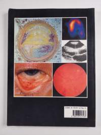 A colour atlas of heart failure