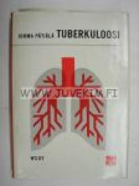 Tuberkuloosi Potilaan hoito ja vastustamistyön yleinen kulku