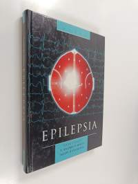 Epilepsia