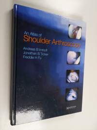 An atlas of shoulder arthroscopy