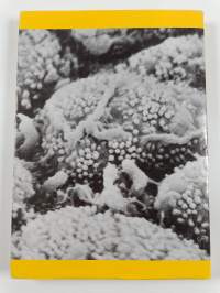Campylobacter pylori