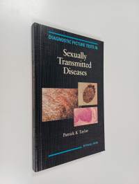 Diagnostic picture tests in sexually transmitted diseases