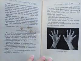 Muutamia tavallisimpia tauteja - niiden ehkäiseminen ja hoito