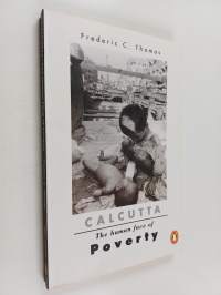 Calcutta Poor - The human face of poverty
