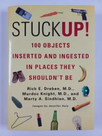 Stuck Up! - 100 Objects Inserted and Ingested in Places They Shouldn’t Be