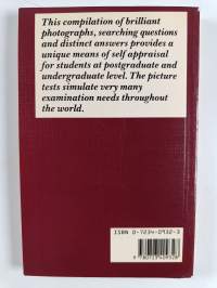 Diagnostic Picture Tests in Obstetrics &amp; Gynaecology