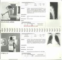 Aufnahmhelfer fur die Röntgendiagnostik